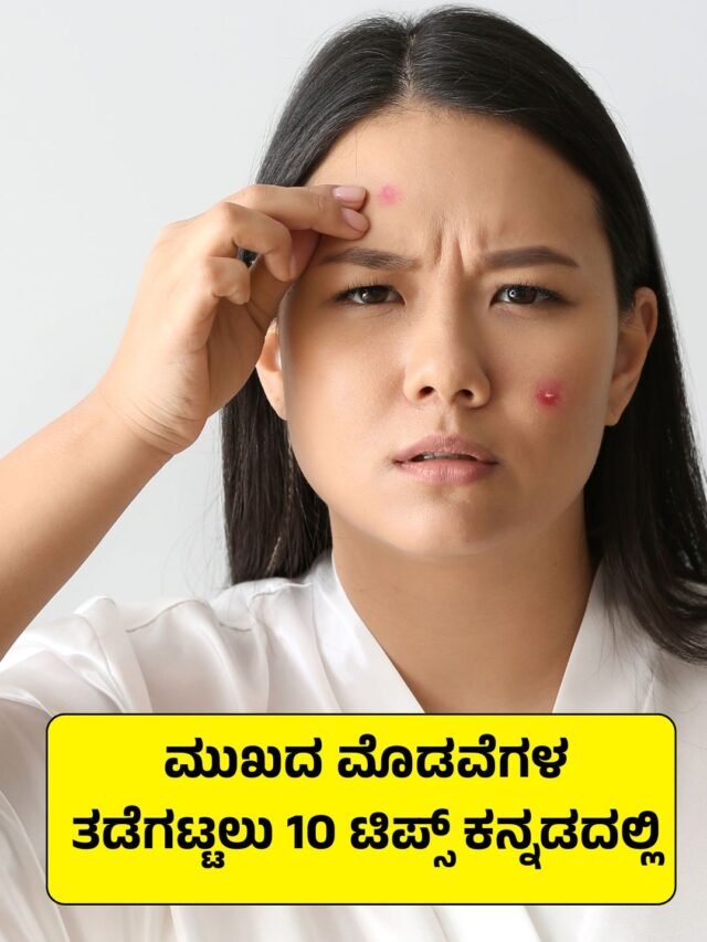 ಮುಖದ ಮೊಡವೆಗಳ ತಡೆಗಟ್ಟಲು 10 ಟಿಪ್ಸ್ ಕನ್ನಡದಲ್ಲಿ