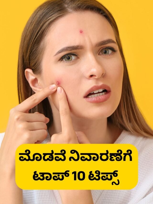 ಮೊಡವೆ ನಿವಾರಣೆಗೆ ಟಾಪ್ 10 ಟಿಪ್ಸ್